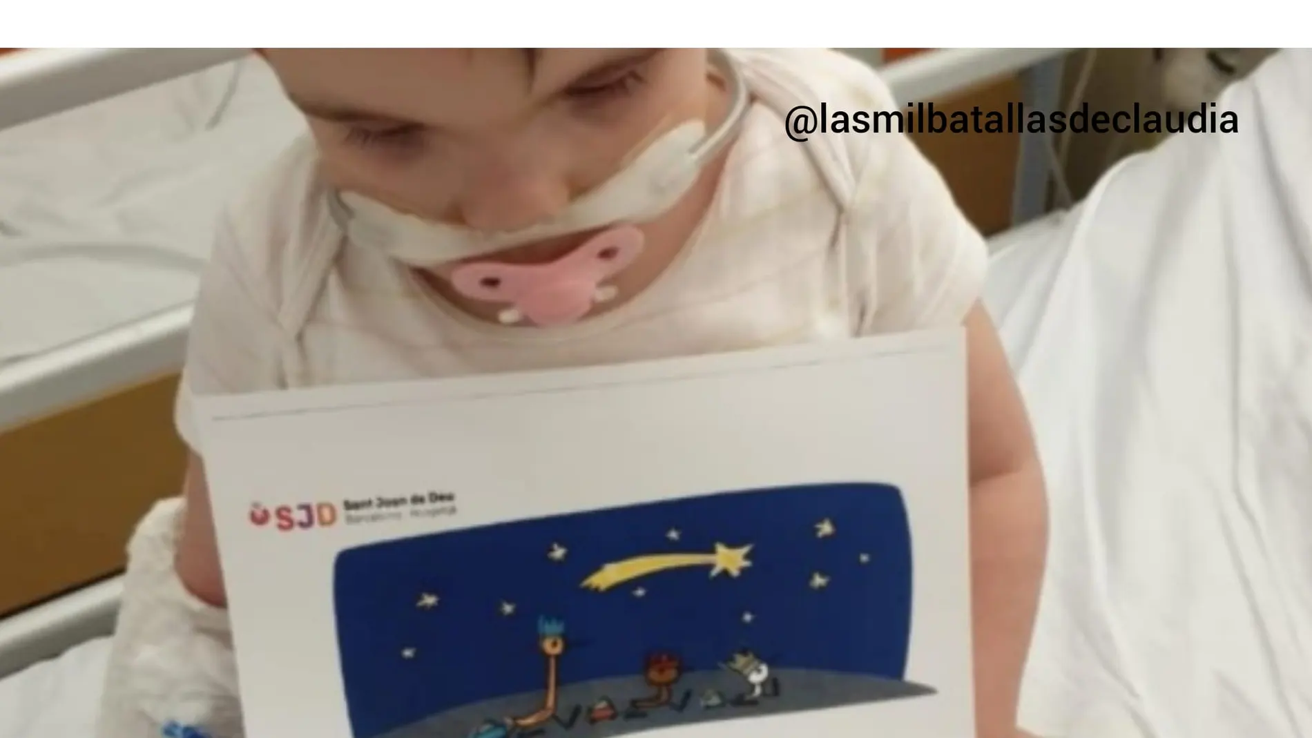 Claudia, la primera niña con Menke-Hennekam en España Claudia, la primera niña con Menke-Hennekam en España