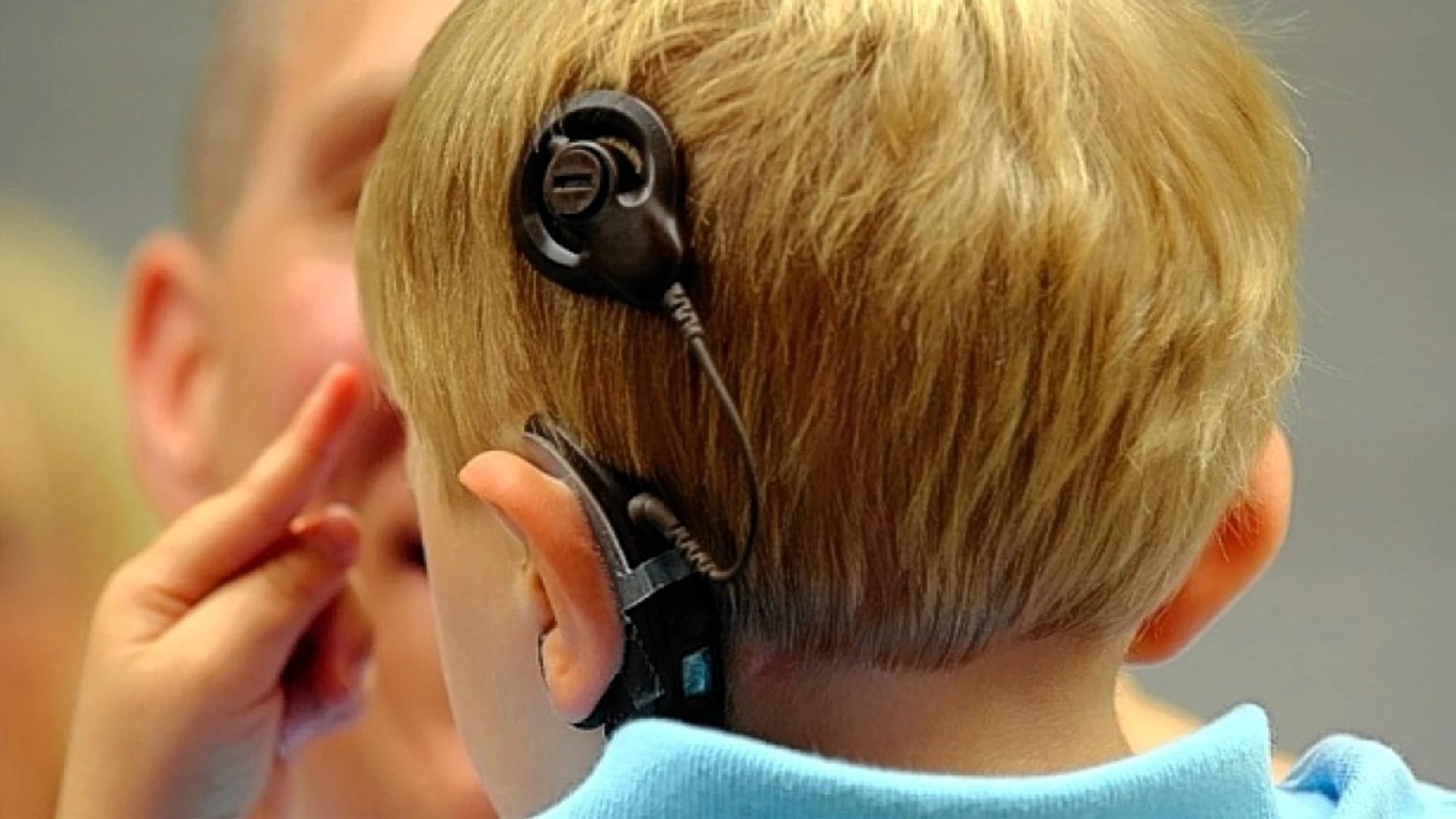 Слабослышащие и позднооглохшие дети. Аппарат для глухих кохлеарная имплантация. Кохлеарная имплантация Cochlear. Кохлеарная имплантация Евромакс. Кохлеарная имплантация Cochlear 7.