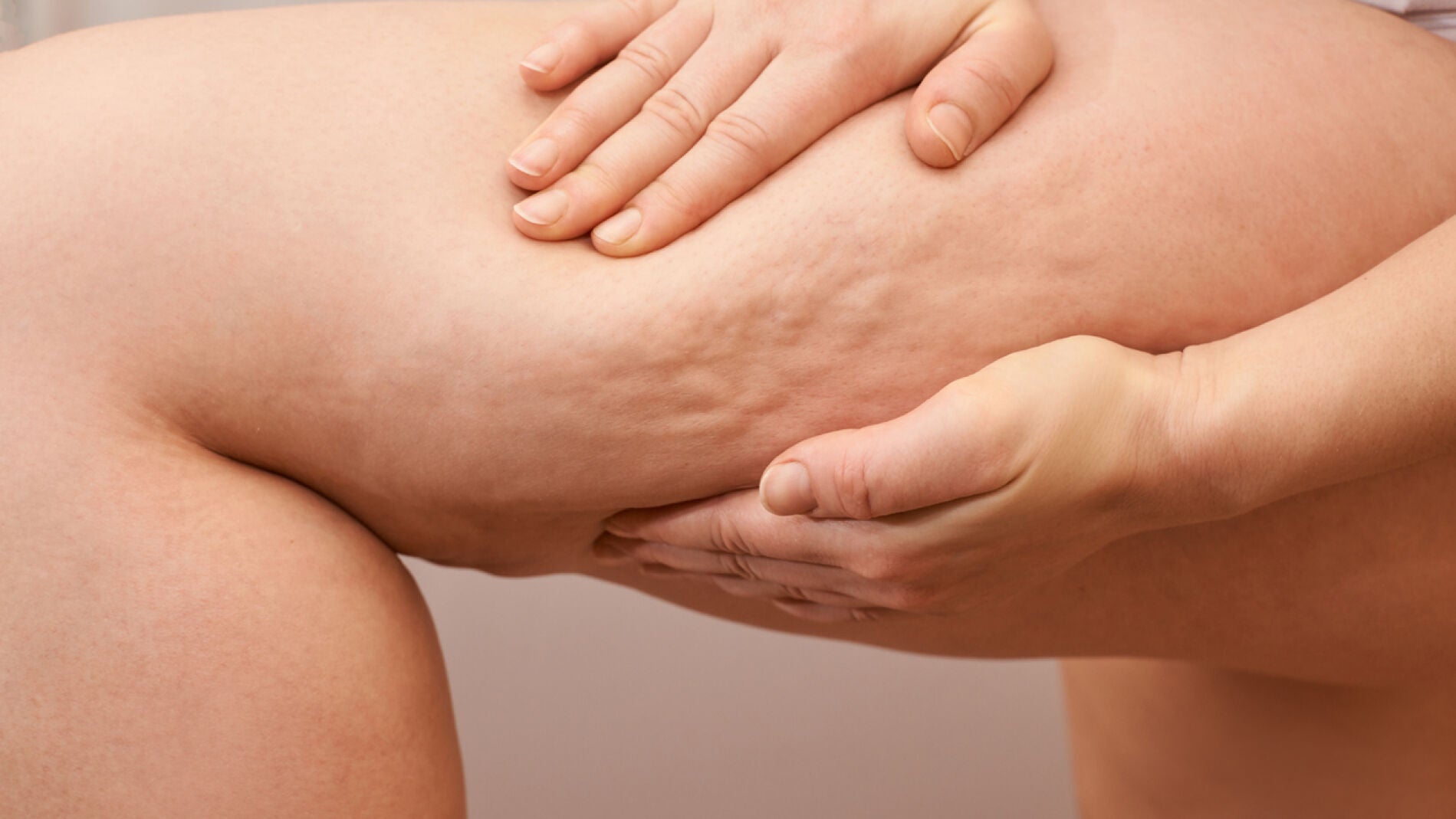 Celulitis