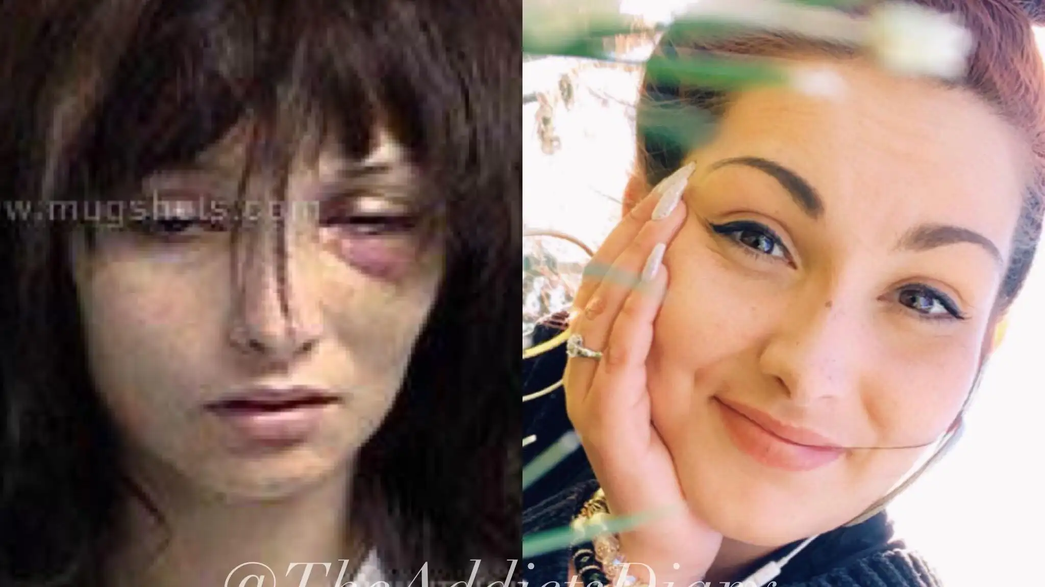 La impactante transformación de una joven adicta a las drogas desde los 15 años después de 3 sobria La impactante transformación de una joven adicta a las drogas desde los 15 años después de 3 sobria