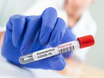 Positivo coronavirus