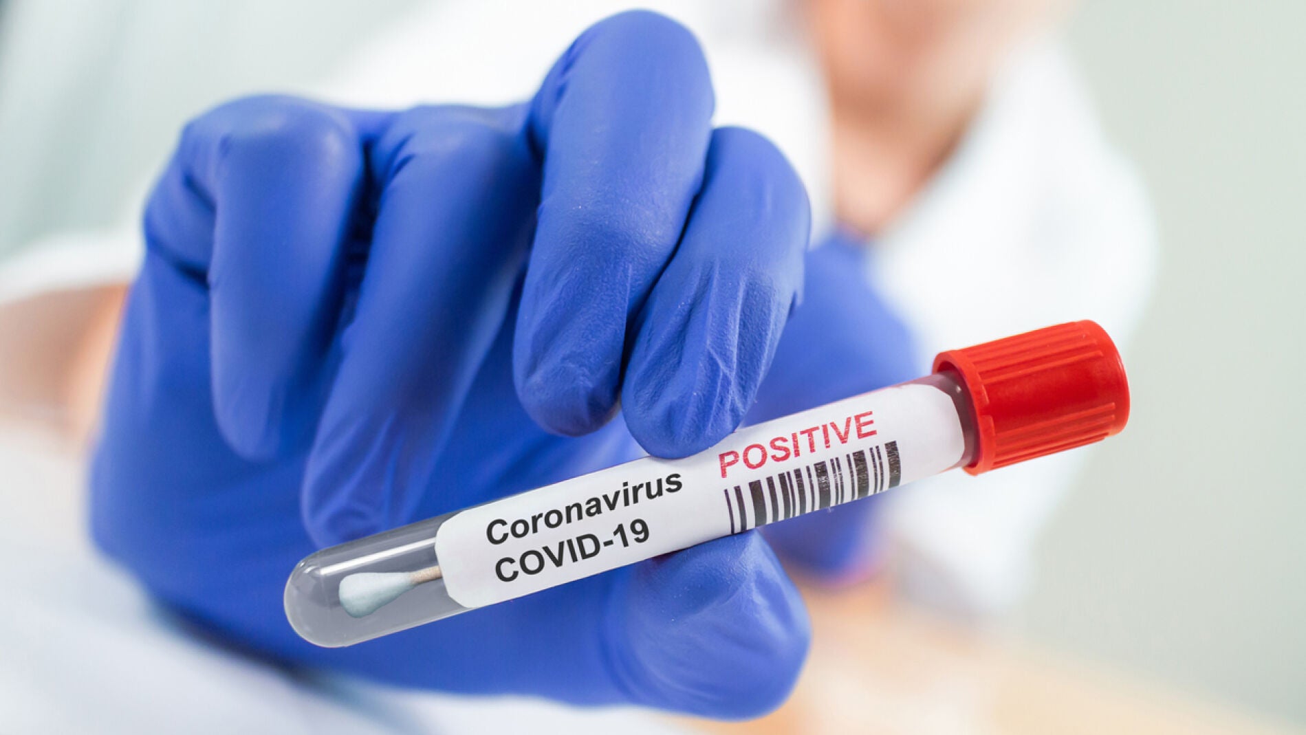 Positivo coronavirus