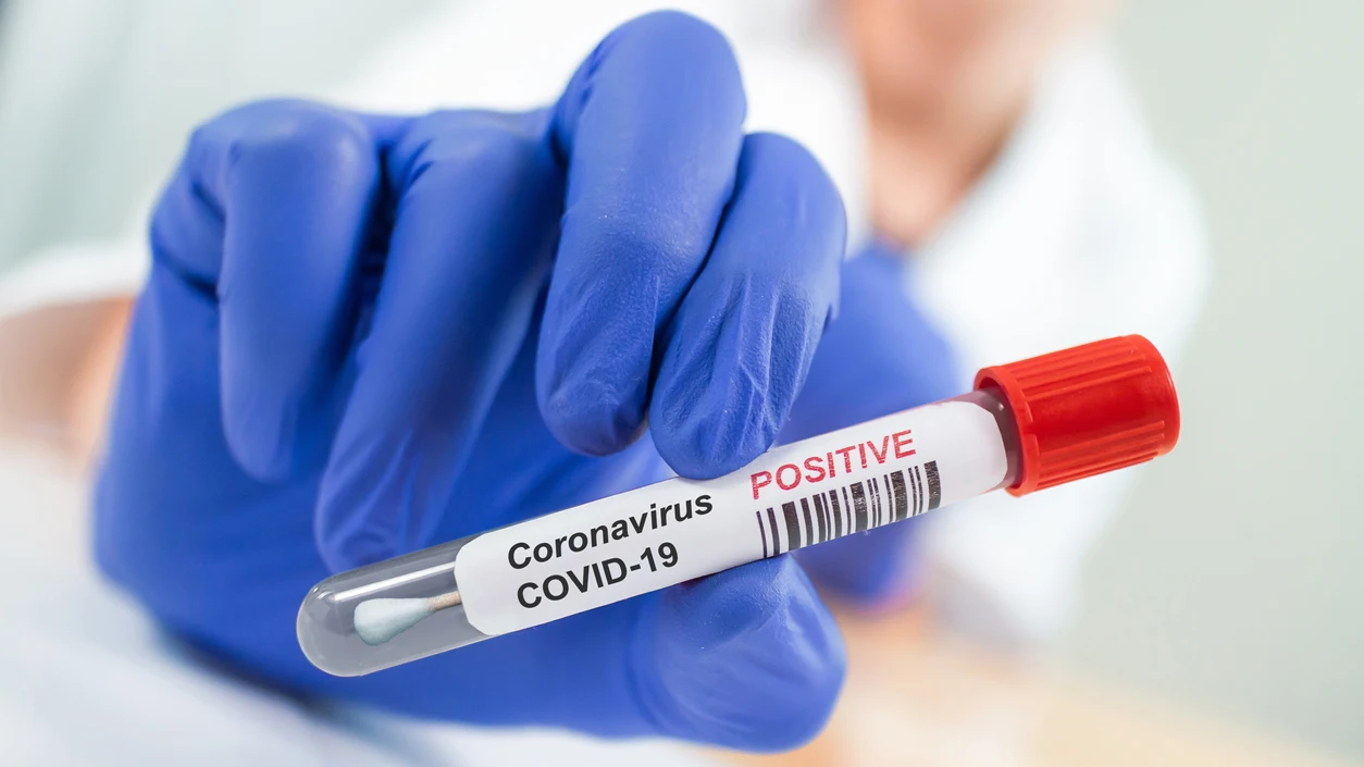 Positivo coronavirus Positivo coronavirus