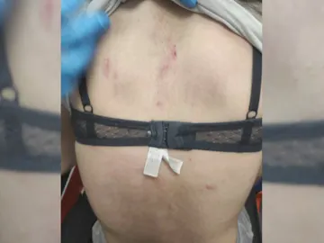 Menor agredida. Menor agredida.