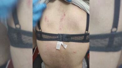La agonía de la joven de 16 años apaleada en Málaga: 