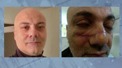 Desfigura la cara a un policía que mediaba en una pelea en Torremolinos con un vaso de tubo