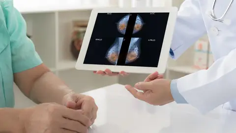 Cáncer de mama Cáncer de mama