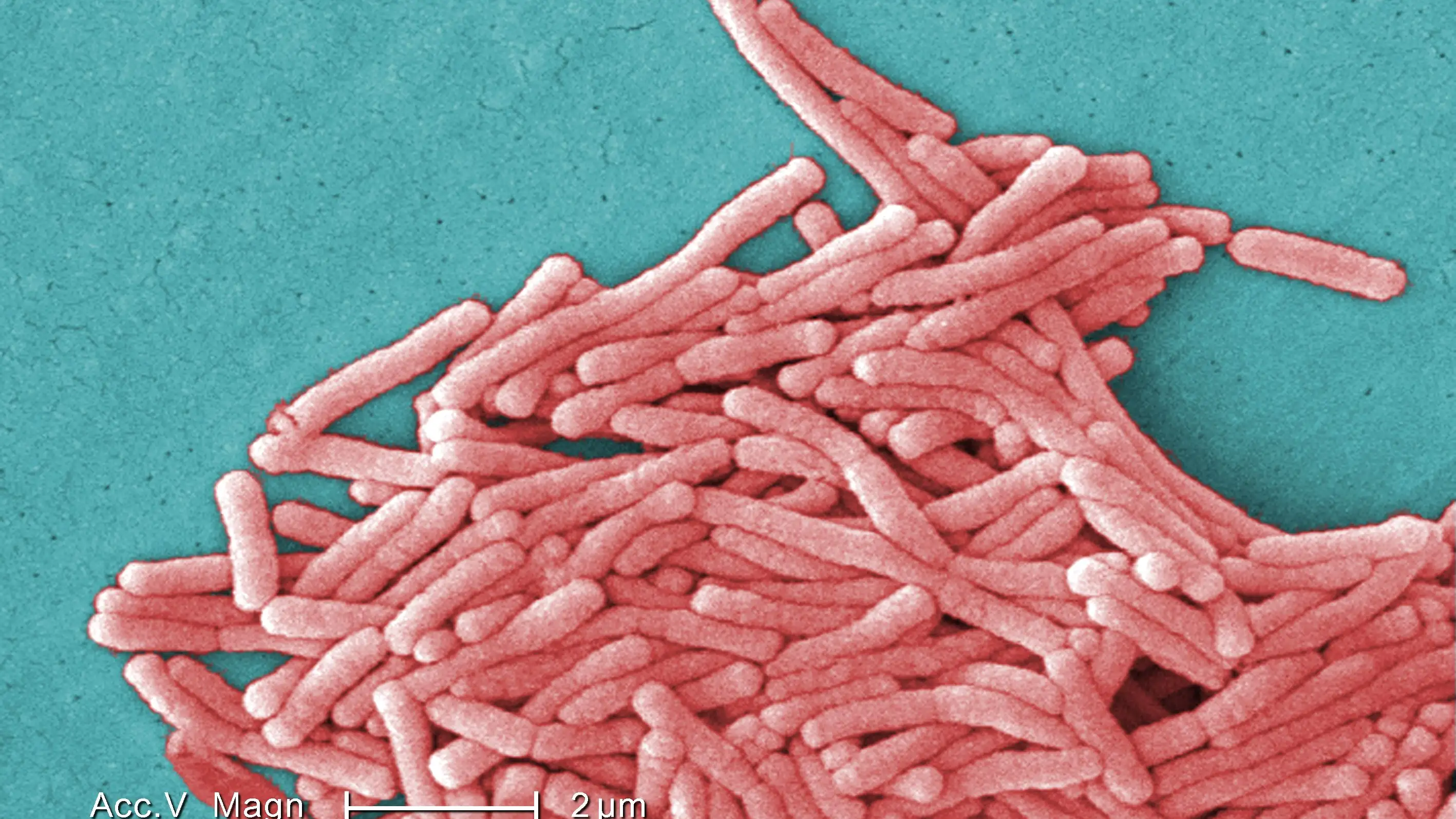 Salud investiga tres brotes de legionelosis en el Vallès Occidental en Barcelona Salud investiga tres brotes de legionelosis en el Vallès Occidental en Barcelona