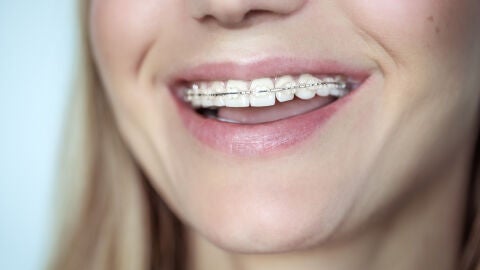 Brackets