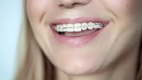 Brackets Brackets