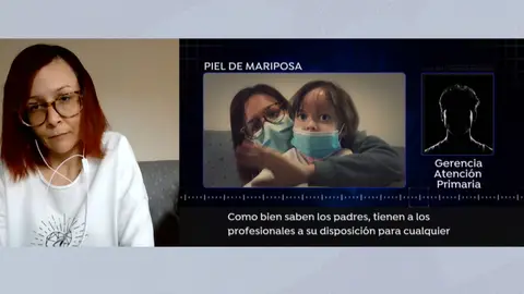 Afectadas por la enfermedad de piel de mariposa. Afectadas por la enfermedad de piel de mariposa.