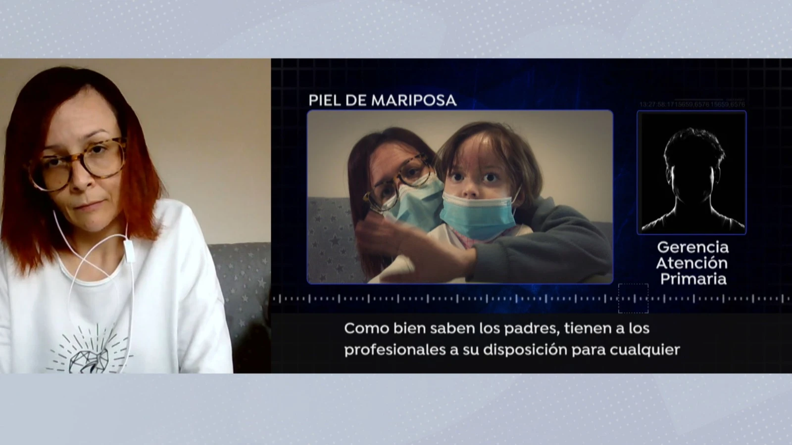 Afectadas por la enfermedad de piel de mariposa. Afectadas por la enfermedad de piel de mariposa.