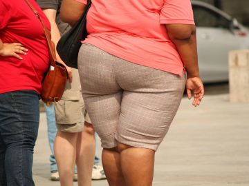 Las personas obesas tienen más riesgo de sufrir una COVID grave, pero no cuentan como grupo de riesgo y deben vacunarse por edad 