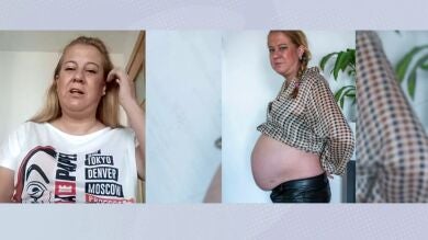 Una mujer lleva con tripa de 'embarazada' 10 años: 