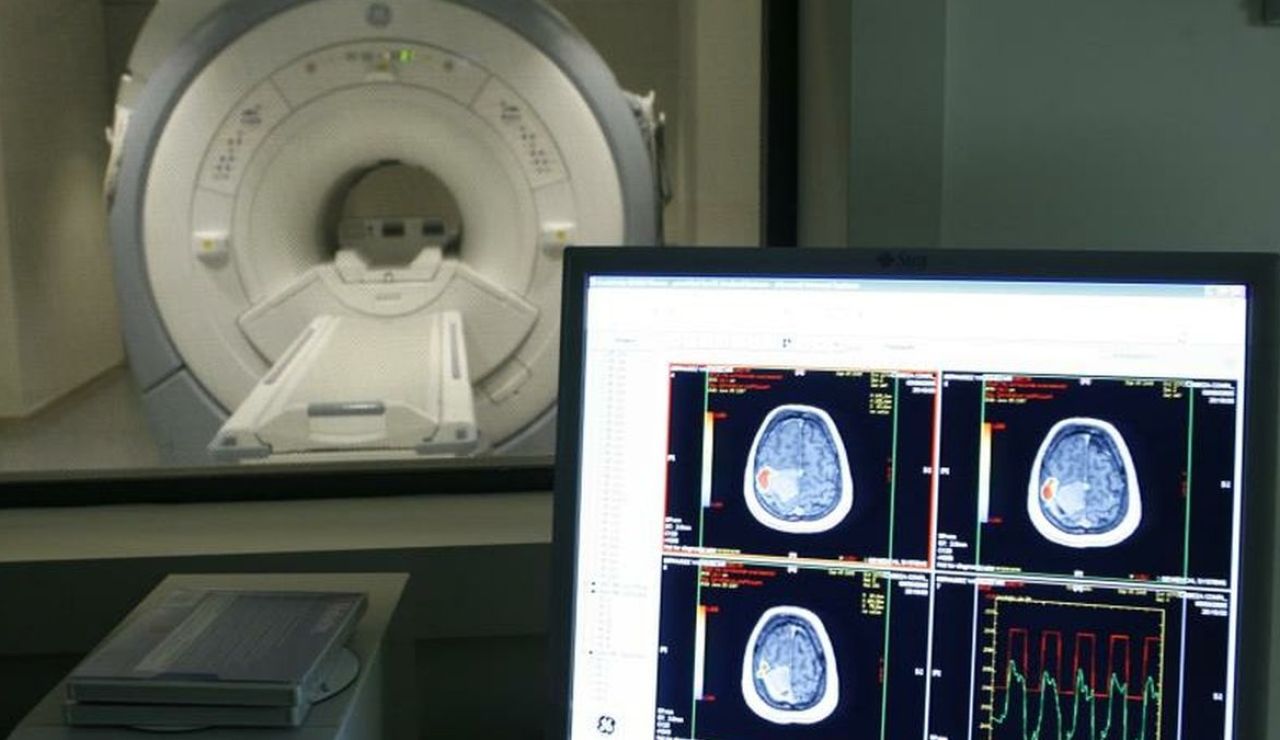 Estados Unidos aprueba un controvertido medicamento contra el Alzheimer porque "los beneficios superan los riesgos" Estados Unidos aprueba un controvertido medicamento contra el Alzheimer porque "los beneficios superan los riesgos"