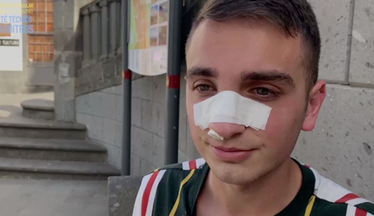 Brutal agresión a un árbitro en un partido de Preferente en Canarias: "Me dio un cabezazo y no recuerdo más" Brutal agresión a un árbitro en un partido de Preferente en Canarias: "Me dio un cabezazo y no recuerdo más"