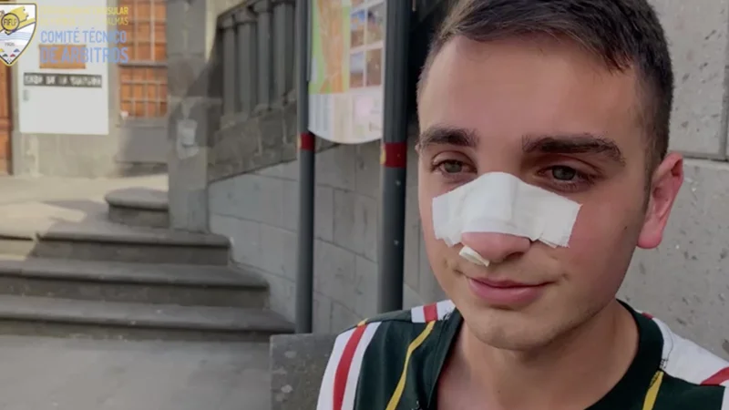 Brutal agresión a un árbitro en un partido de Preferente en Canarias: "Me dio un cabezazo y no recuerdo más" Brutal agresión a un árbitro en un partido de Preferente en Canarias: "Me dio un cabezazo y no recuerdo más"