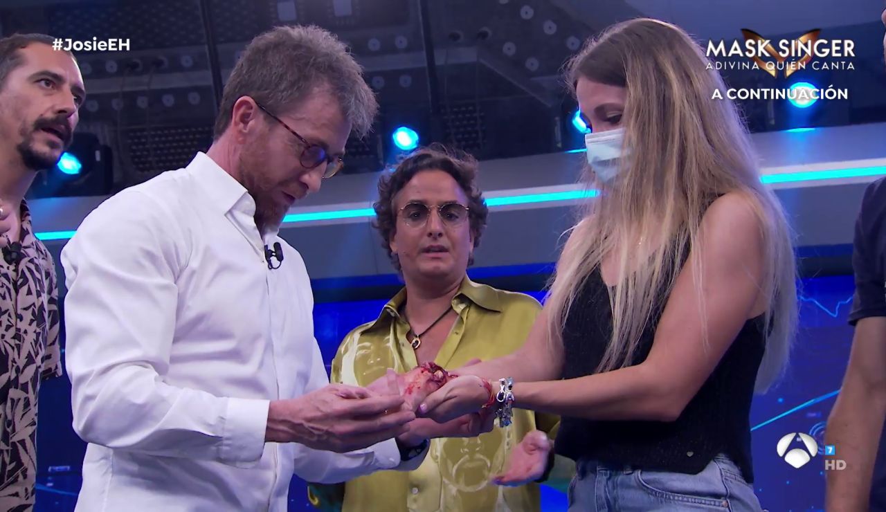 ¡Espeluznante! Marron 'cura' las heridas de un experimento fallido en 'El Hormiguero 3.0' ¡Espeluznante! Marron 'cura' las heridas de un experimento fallido en 'El Hormiguero 3.0'