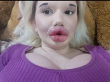 La mujer con los labios más grandes del mundo, Andrea Ivanova, quiere seguir aumentándolos a pesar del rechazo de su familia 
