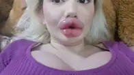 La mujer con los labios m&aacute;s grandes del mundo, Andrea Ivanova, quiere seguir aument&aacute;ndolos a pesar del rechazo de su familia 