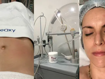 Así es Beoxy Platino, lo último en tratamientos corporales Así es Beoxy Platino, lo último en tratamientos corporales