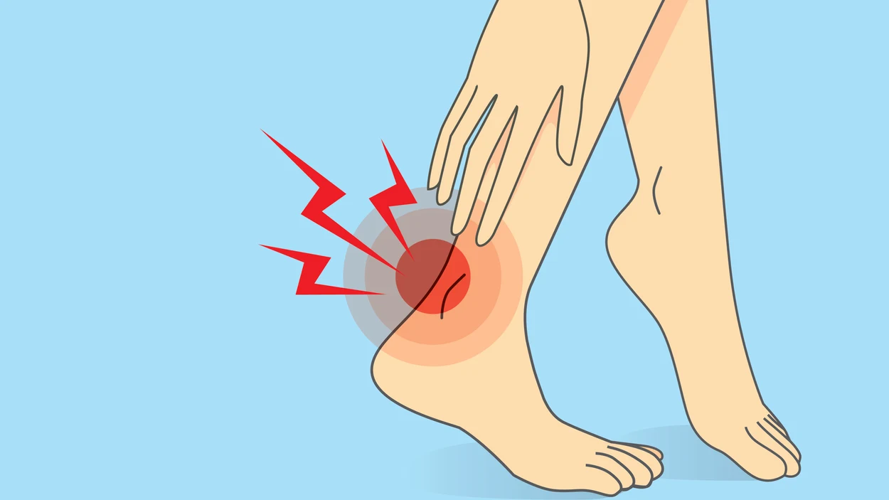 Roce del calzado en los pies Roce del calzado en los pies