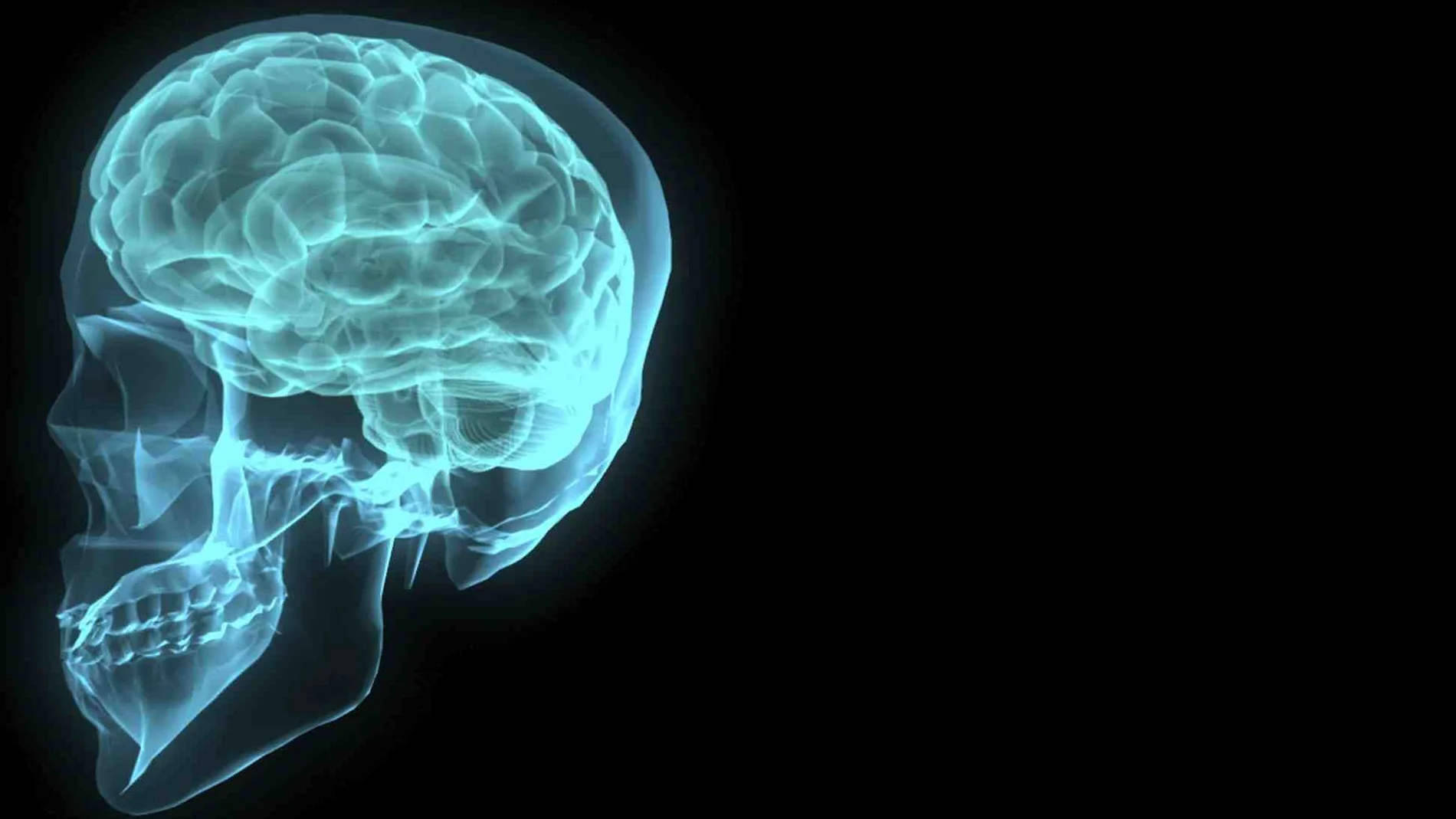 Recreación artística de un cerebro humano contenido en el cráneo Recreación artística de un cerebro humano contenido en el cráneo