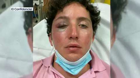 El 'pequeño Nicolás' acaba hospitalizado tras un incidente con un vigilante de un concierto en Marbella El 'pequeño Nicolás' acaba hospitalizado tras un incidente con un vigilante de un concierto en Marbella