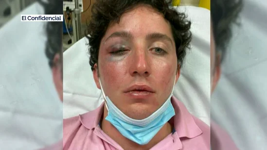El 'pequeño Nicolás' acaba hospitalizado tras un incidente con un vigilante de un concierto en Marbella El 'pequeño Nicolás' acaba hospitalizado tras un incidente con un vigilante de un concierto en Marbella