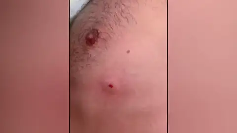 Francisco Montiel recibió varias balas de perdión mientras hacía un triatlón Francisco Montiel recibió varias balas de perdión mientras hacía un triatlón