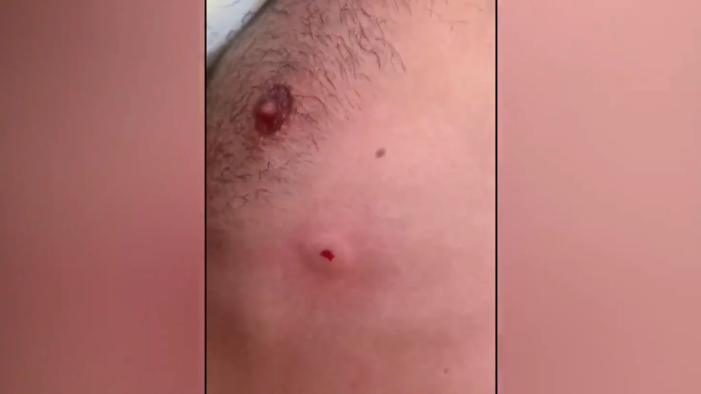 Francisco Montiel recibió varias balas de perdión mientras hacía un triatlón Francisco Montiel recibió varias balas de perdión mientras hacía un triatlón