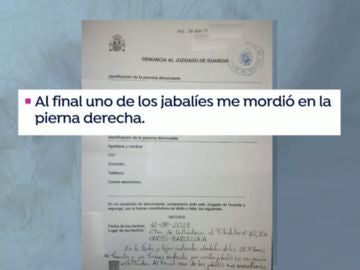 Un vecino denuncia al Ayuntamiento de Barcelona por la mordedura de un jabalí