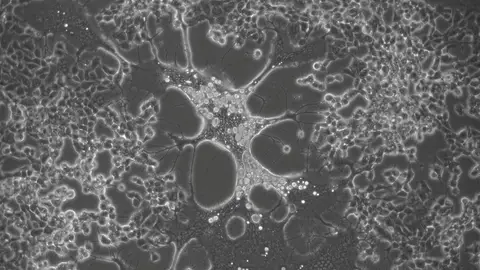El virus del herpes genital humano evoluciona mas rapido que el labial El virus del herpes genital humano evoluciona mas rapido que el labial