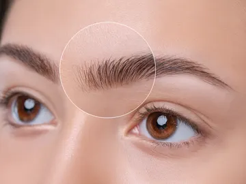 ¿Caspa en las cejas? ¿Caspa en las cejas?
