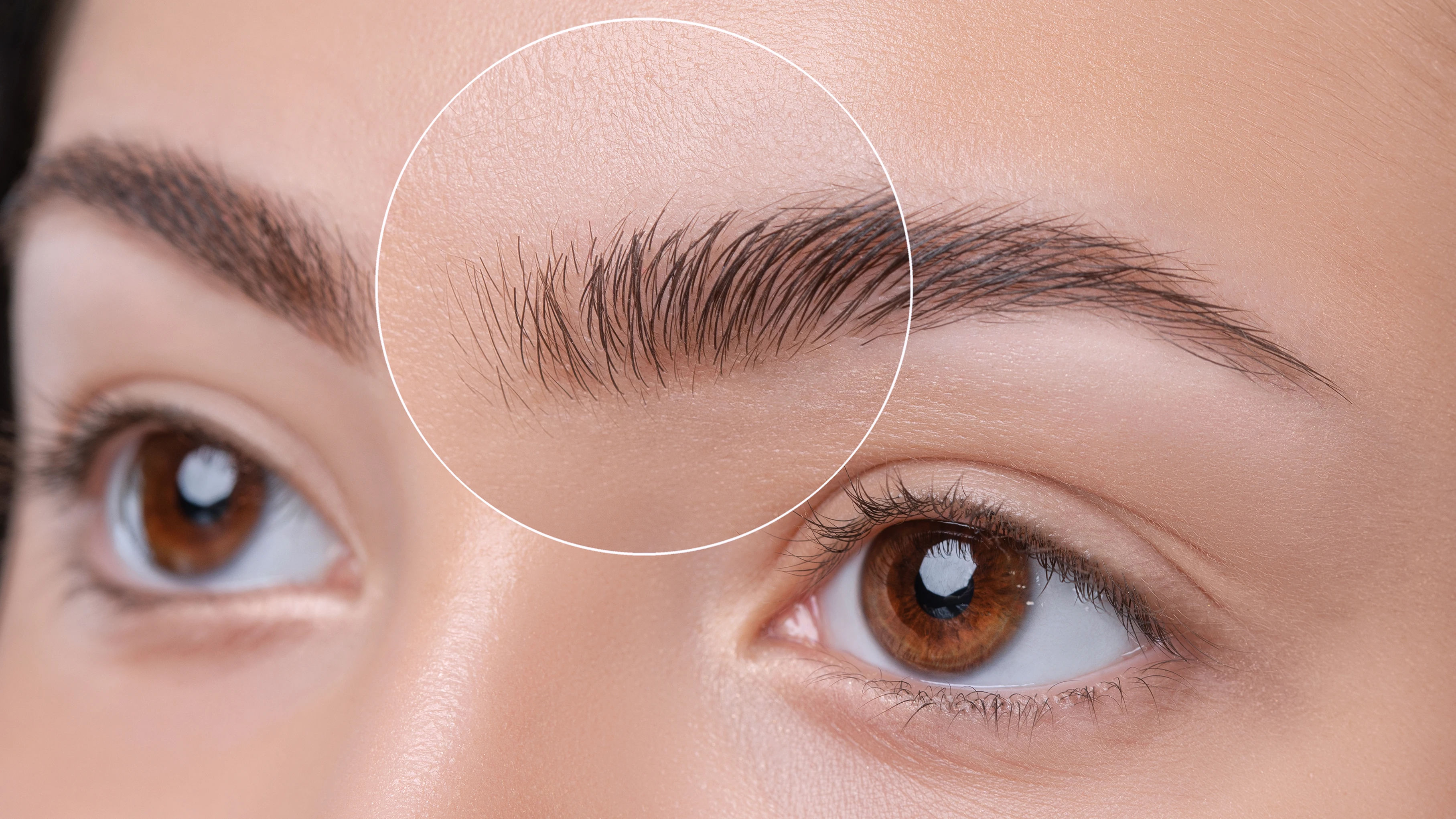 ¿Caspa en las cejas? ¿Caspa en las cejas?