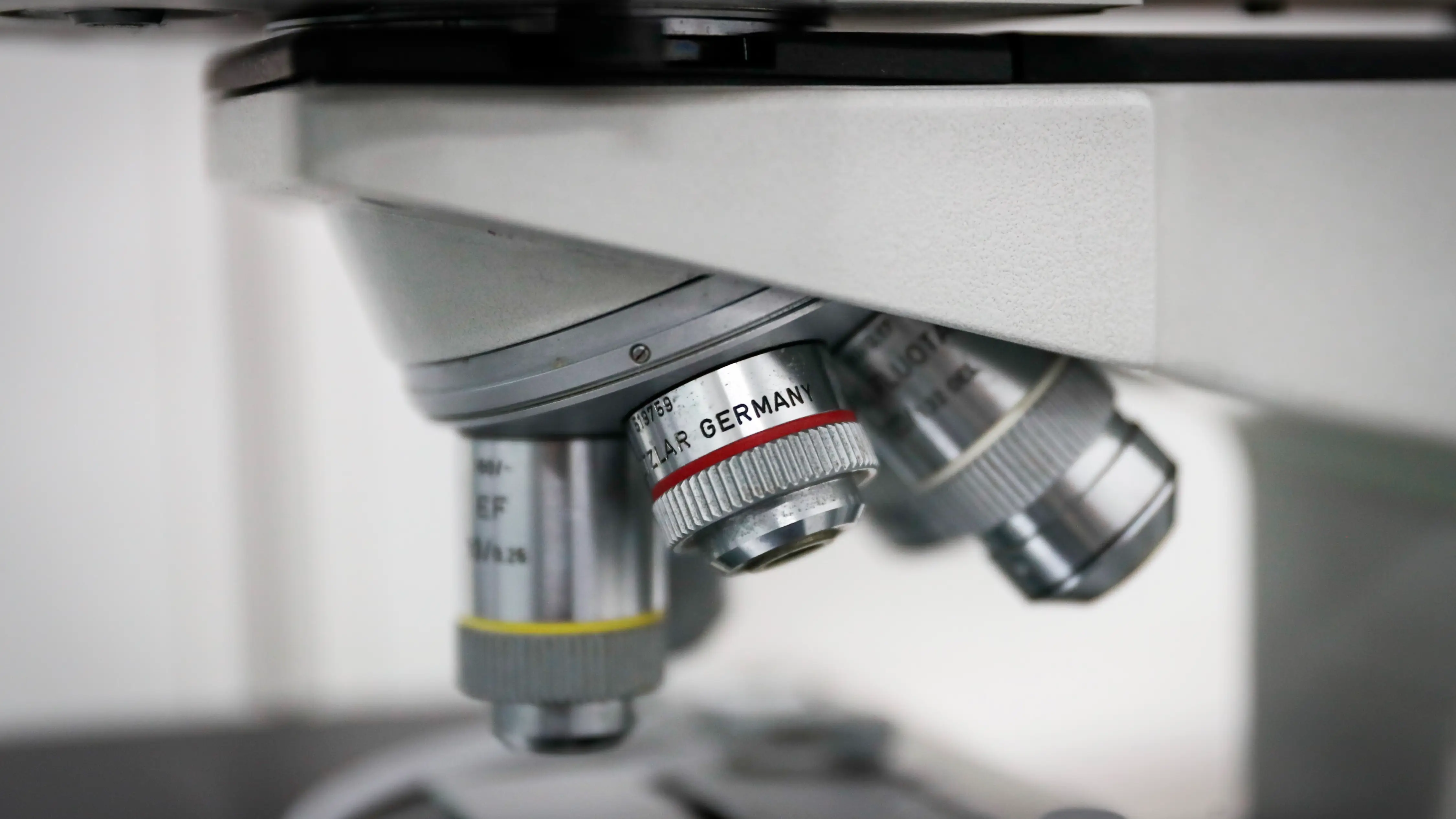 Crean un algoritmo que permite predecir el alzheimer con una precisi&oacute;n del 99%