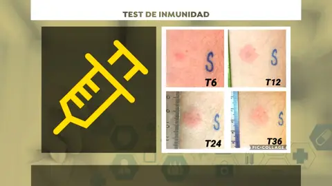 Test inmunidad Test inmunidad