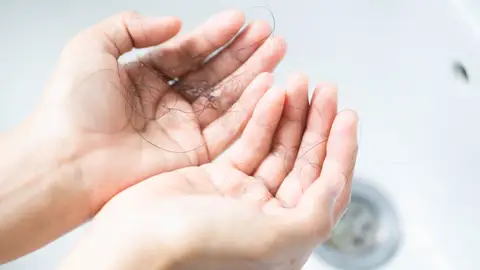 Pelo Pelo