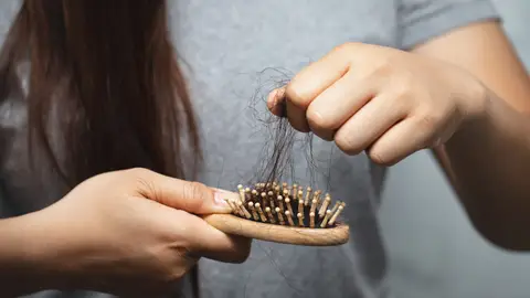 Pérdida de pelo Pérdida de pelo