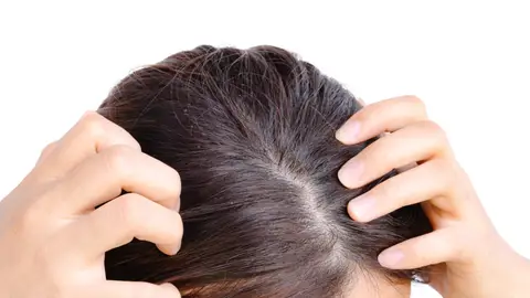 Raíz del cabello Raíz del cabello