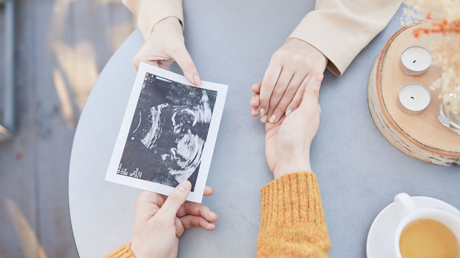 Donación de óvulos: ¿cuándo te la deberías plantear?