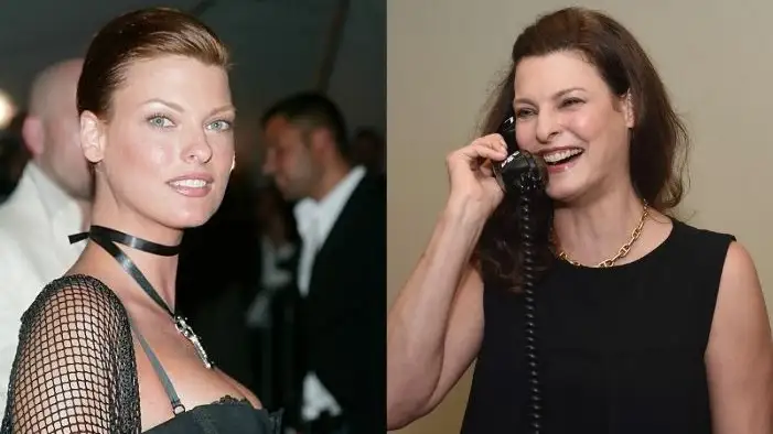 Qu&eacute; es la criolip&oacute;lisis, el tratamiento est&eacute;tico que deform&oacute; a la modelo Linda Evangelista