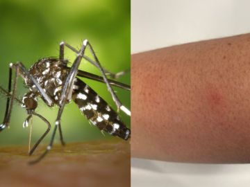 Málaga y Castellón sufren un fuerte brote de mosquitos tigre después del verano