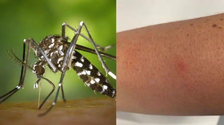 M&aacute;laga y Castell&oacute;n sufren un fuerte brote de mosquitos tigre despu&eacute;s del verano