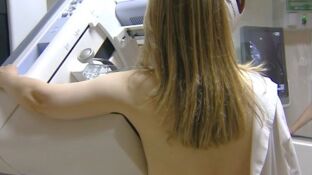 &iquest;Qu&eacute; probabilidades hay de curar el c&aacute;ncer de mama?