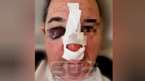 Policía agredido en Zaragoza Policía agredido en Zaragoza