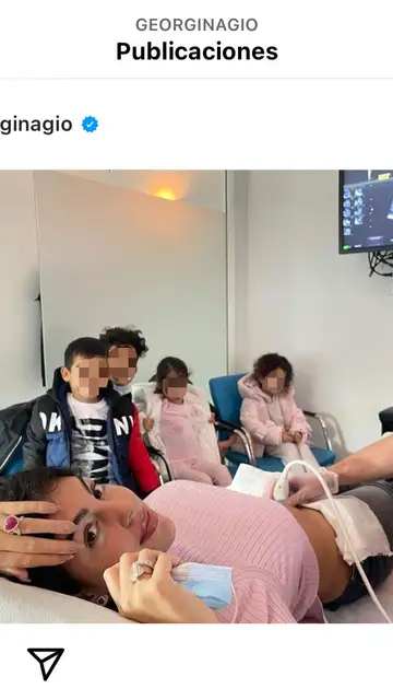 Ecografía Georgina Rodríguez Georgina Rodríguez