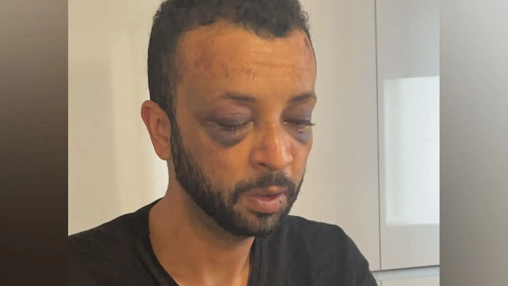 Costillas rotas y hematomas en la cabeza en una brutal agresión homófoba a un joven brasileño en A Coruña Costillas rotas y hematomas en la cabeza en una brutal agresión homófoba a un joven brasileño en A Coruña