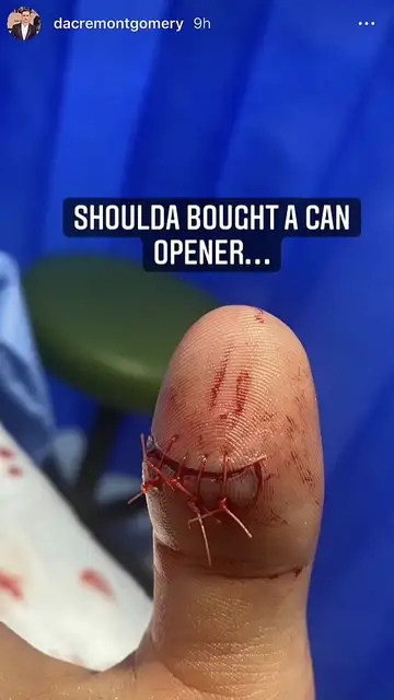 La grimosa foto del dedo de Dacre Montgomery La grimosa foto del dedo de Dacre Montgomery