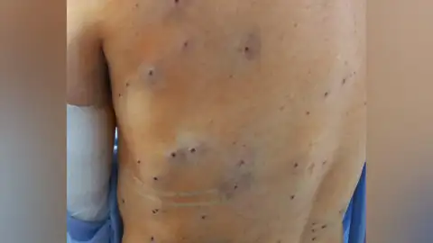 Un cazador confunde a un ciclista con un conejo y le dispara una ráfaga de perdigones Un cazador confunde a un ciclista con un conejo y le dispara una ráfaga de perdigones